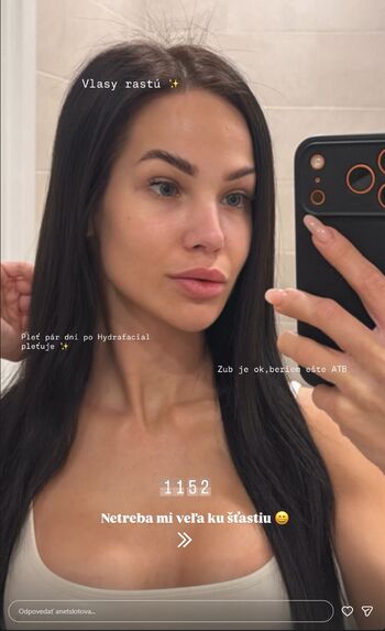 Full leaked Anet slotova private onlyfans photo