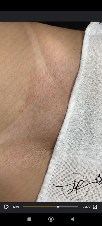 Bronzeamento Natural