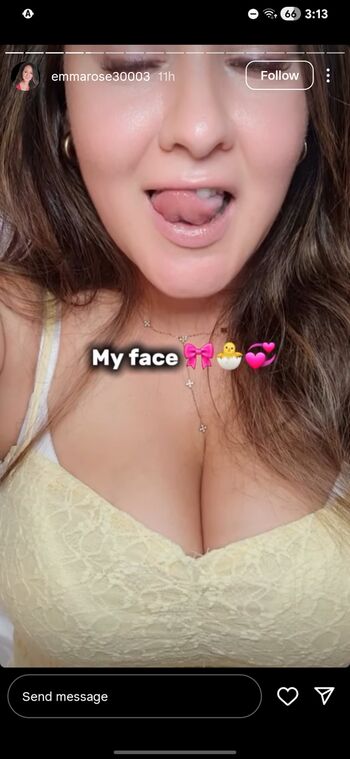 Full leaked Emmarose private photo