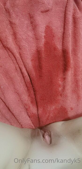 Full leaked Kandyk page private photo