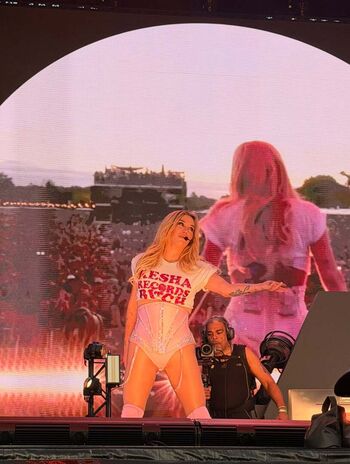 Full leaked Kesha private onlyfans photo