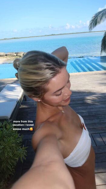 Livvy Dunne