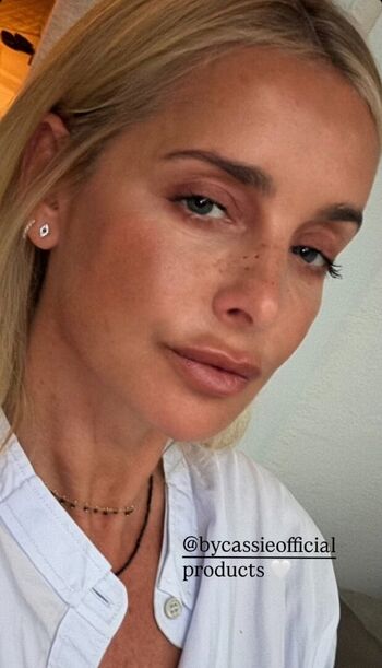 Full leaked Louise redknapp private photo