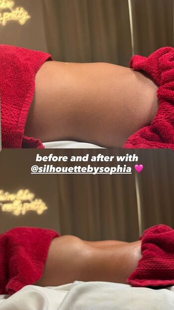 Full leaked Mackenzie ziegler page private onlyfans photo