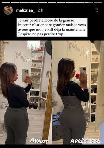 Full leaked Meliznaa private photo