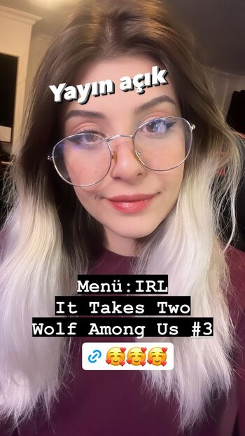 Full leaked Rem sakmar private onlyfans photo