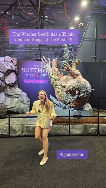 Full leaked Sjokz page private photo