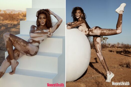 Full leaked Winnieharlow private photo