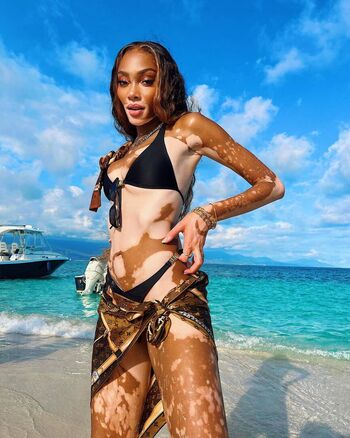 winnieharlow
